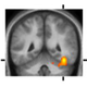 Illustration for article titled How Hatred Transforms Your Brain